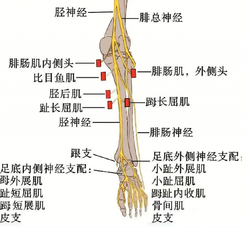 腓总神经走行解剖图图片