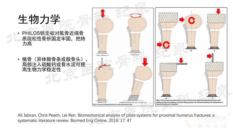 肱骨近端骨折微创OR传统中文版_页面_14_副本.jpg