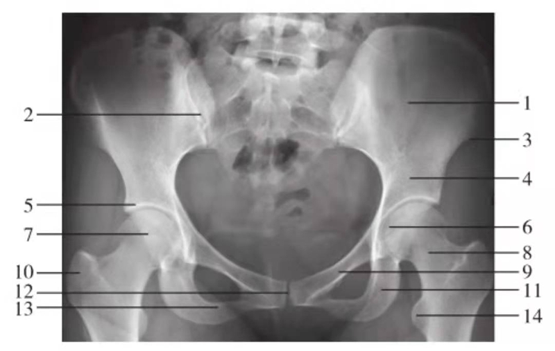 骨盆x线解剖图图片