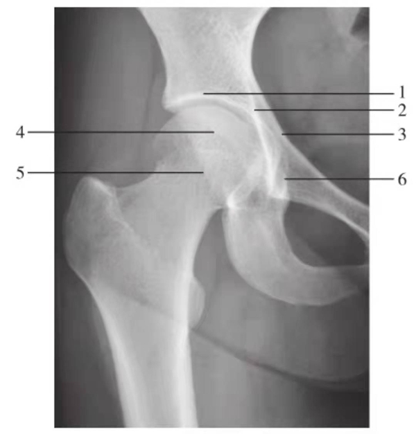 一文掌握正常髋关节x线解剖示意图